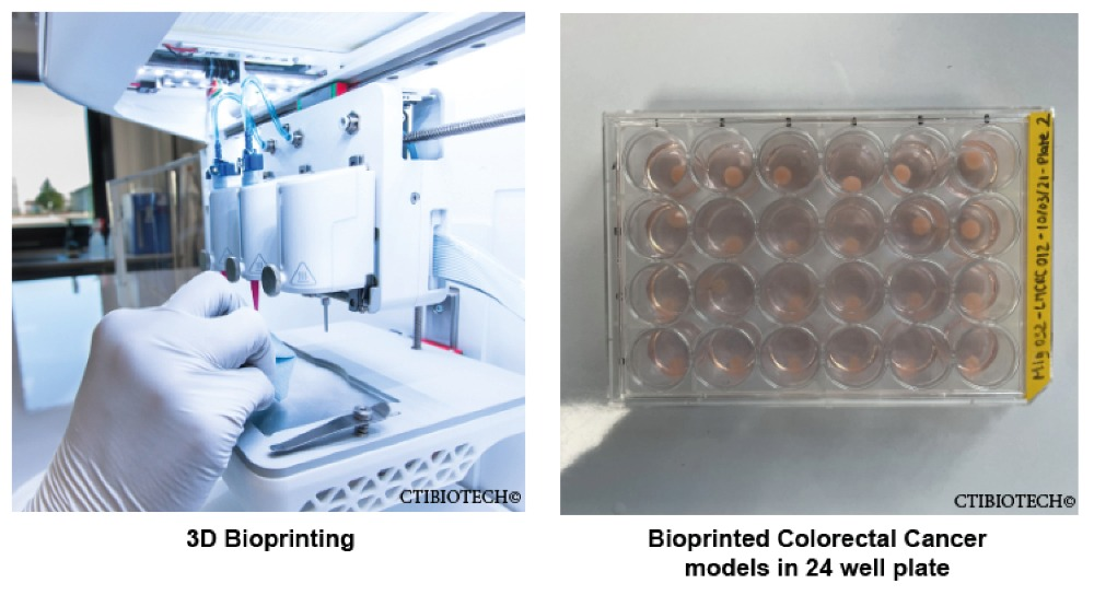 CTIBIOTECH Develops Novel 3D Bioprinting Platform to Treat Colon Cancer