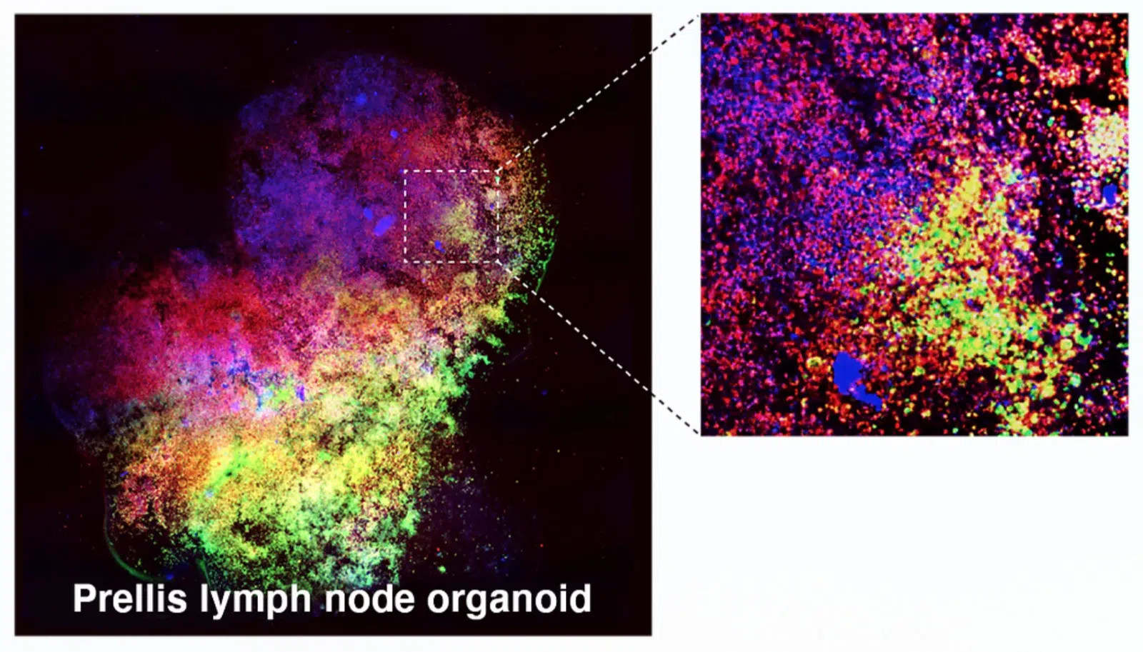 Prellis Biologics to provide human lymph node organoids for research Bioprinting