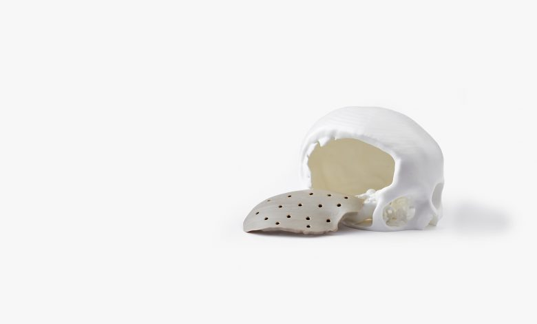 3D Systems Targets PEEK Implants with Acquisition of Kumovis