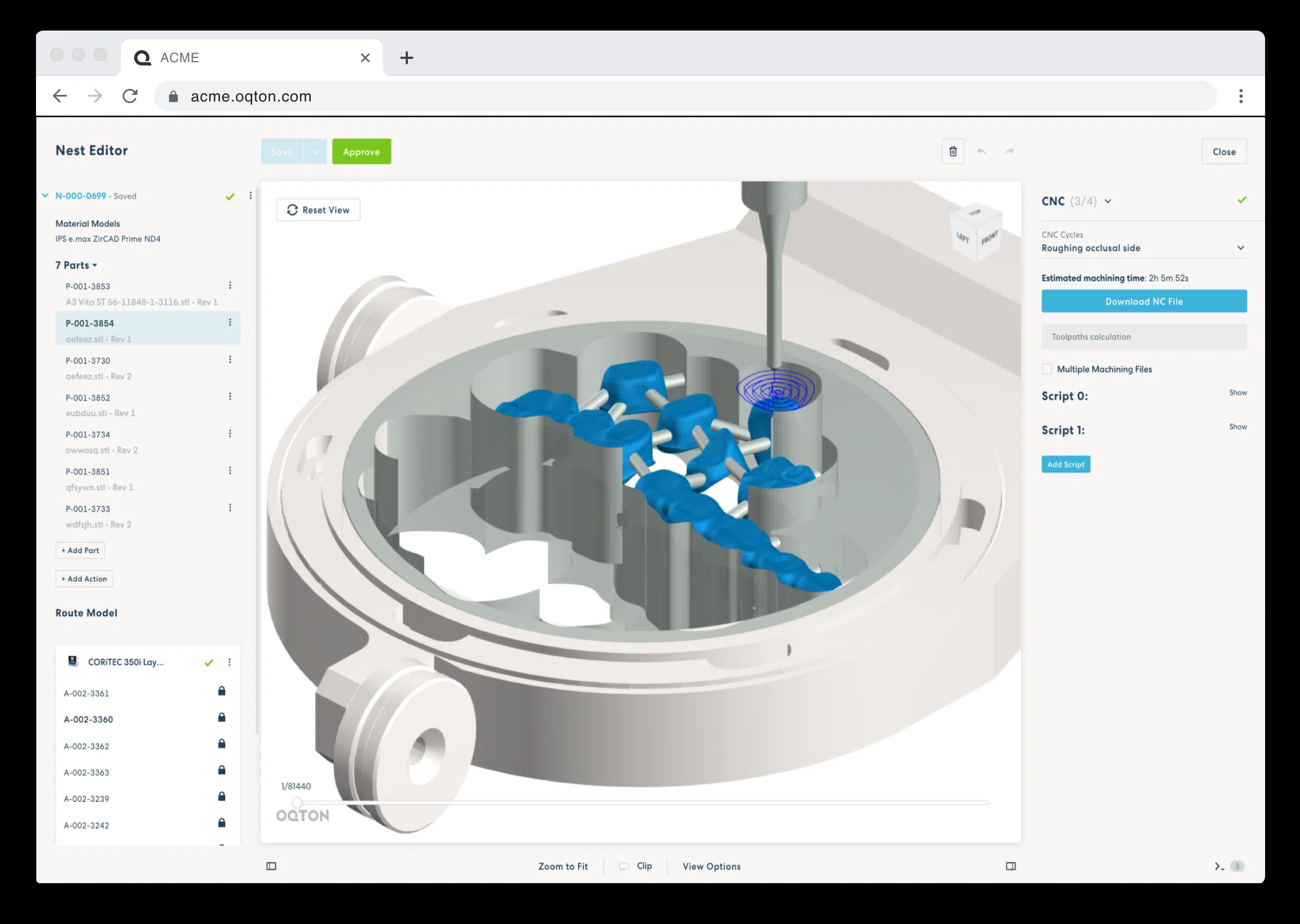 Oqton and Eplus3D enter dental 3D printing partnership Medical