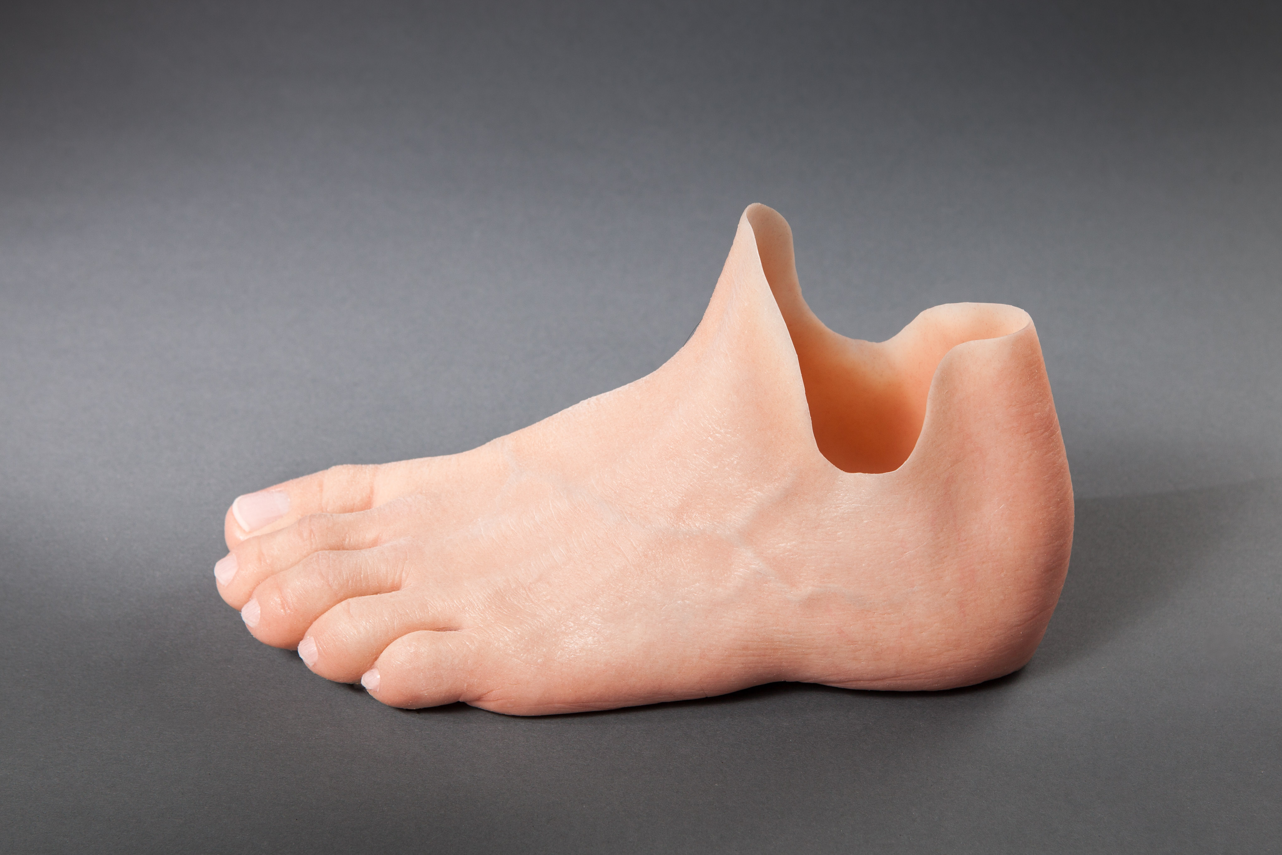 Foot prosthetics 3D printed by a German startup. Source: 3printr